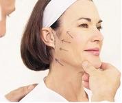 Yanak Çizgileri Nasıl Giderilir?